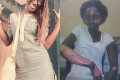 Nigerian Lady Who Survived Fatal Gas Explosion Shares Photos 3 Years After 