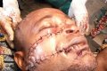 Herdsmen Attack Man Inside His Farm, Inflict Deep Machete Cuts On Him In Edo (Graphic Photos)