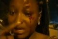 University Student Left Bloody-eyed After Being Allegedly Assaulted By Police (Video) 