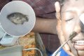 Fish Stuck In Boy