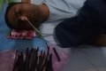 Shocker! Doctors Remove 33 Objects Including Razor Blades And Screwdriver From A Man