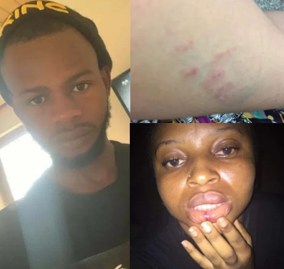 Nigerian Lady Tells How She Was Allegedly Beaten And R