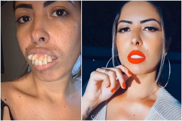 Woman's Amazing Teeth 'Transformation' Gets Millions Of Views, But ...