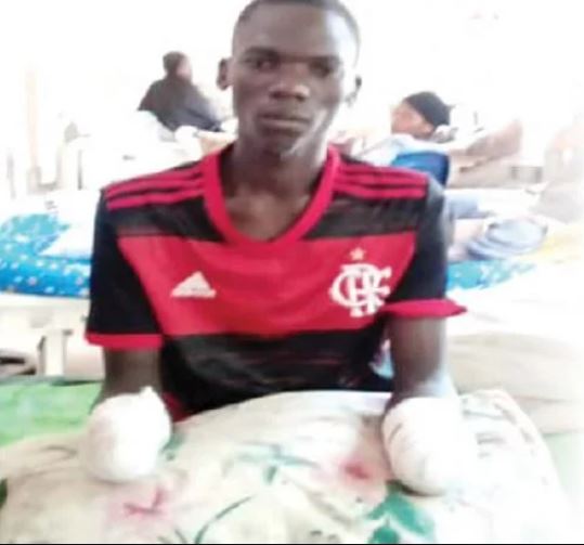 I Craved Death The Day Hoodlums Chopped Off My Hands Despite Collecting My Bike, Phone, Money – Nasarawa Mechanic Laments