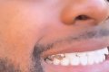 Davido Flaunts New $200K Diamond Encrusted Teeth (Video)