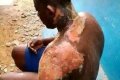 Woman Pours Hot Water On Her Husband During Argument In Niger State