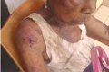 Outrage as 90 Year Old Widow Battles for Life After Shocking Family Ordeal